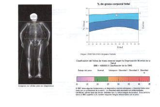 Densitometría ósea