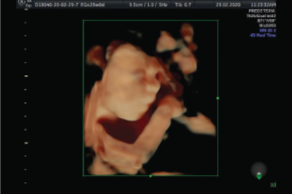 Ecografía Estructural