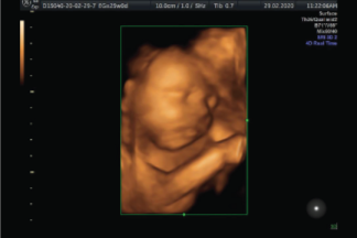 Ecografía Estructural