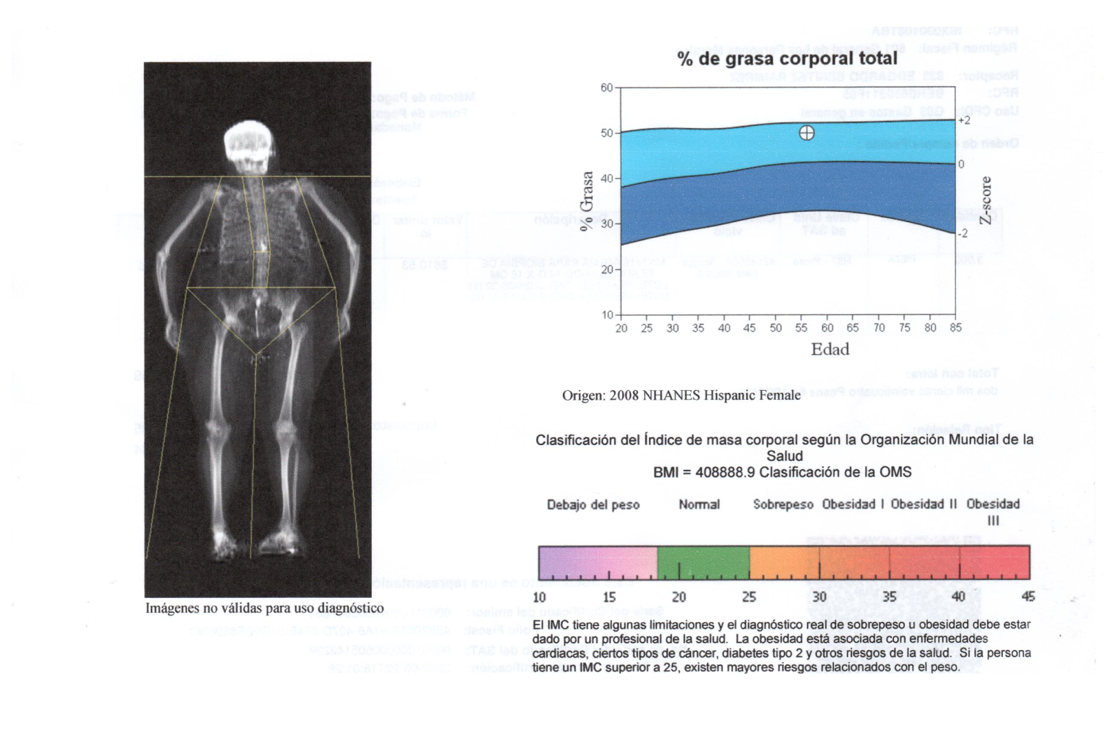 Densitometría ósea