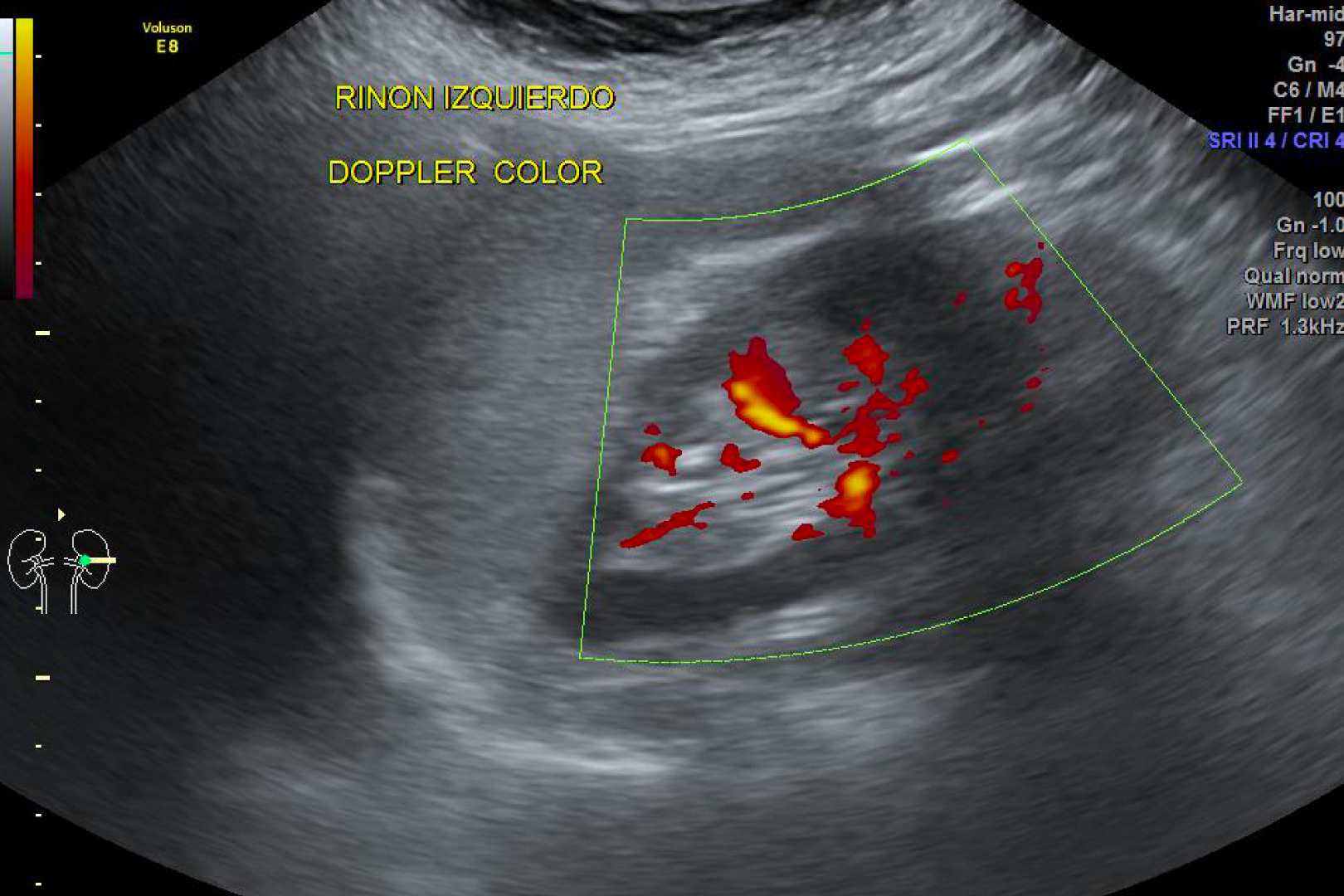 Ultrasonidos generales