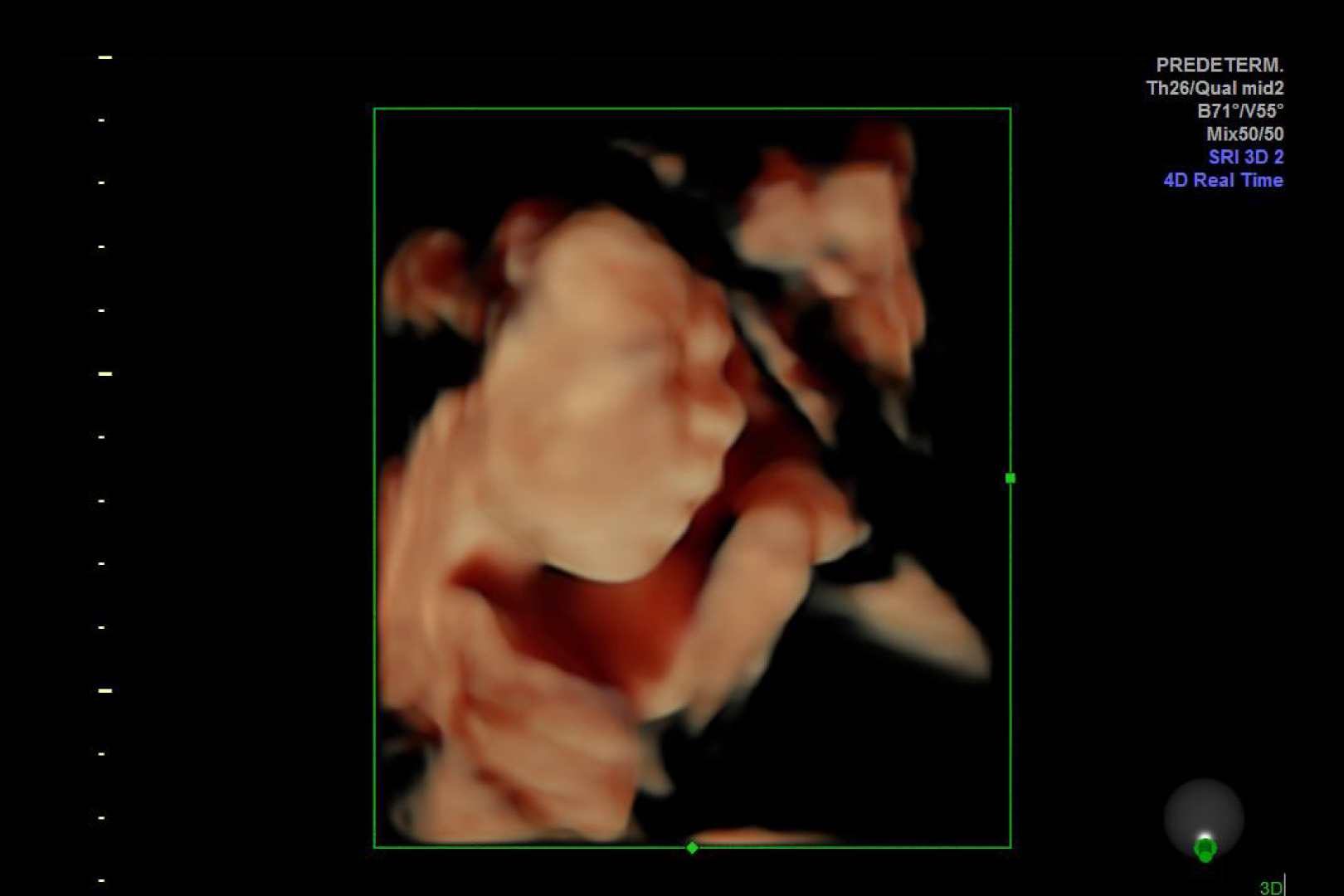 Ecografía Estructural