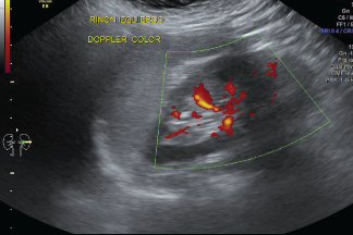 Ecografías Generales
