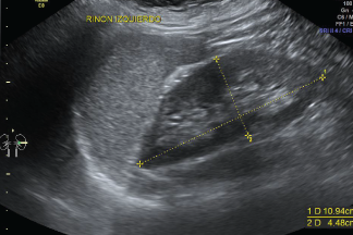 Ecografías Generales