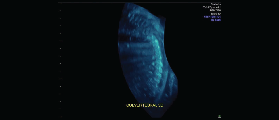 Ecografía Estructural