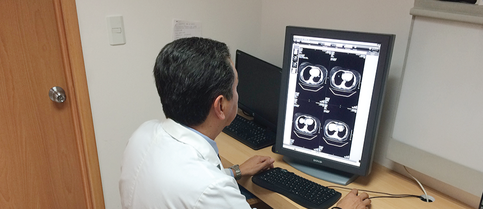 Tomografía computada