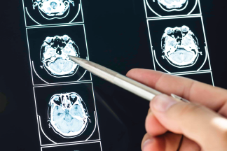 Tomografía computada